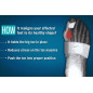 Tynor Bunion Splint (UN) (K 14)